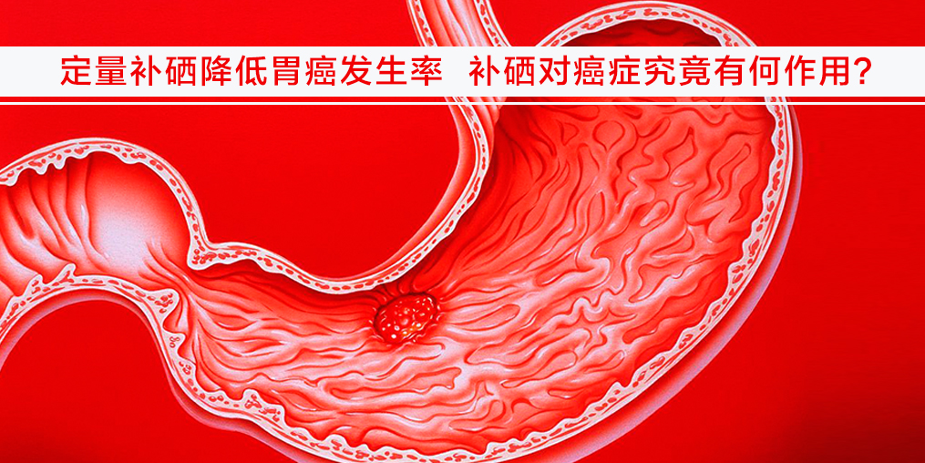 遠離胃癌不難，改變不良習(xí)慣外多補硒