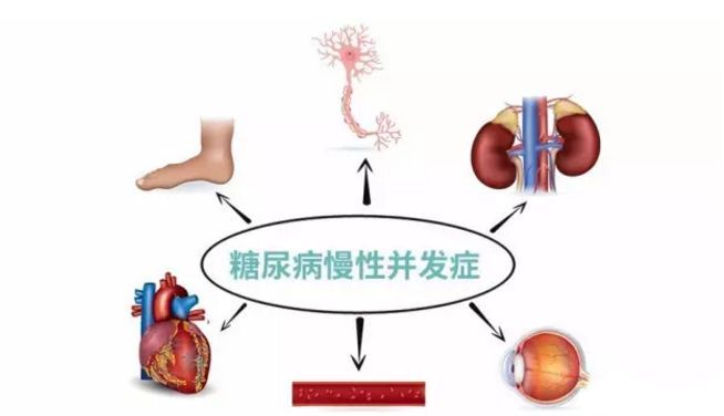 血糖波動(dòng)大，并發(fā)癥來(lái)得快，糖友要多補(bǔ)硒